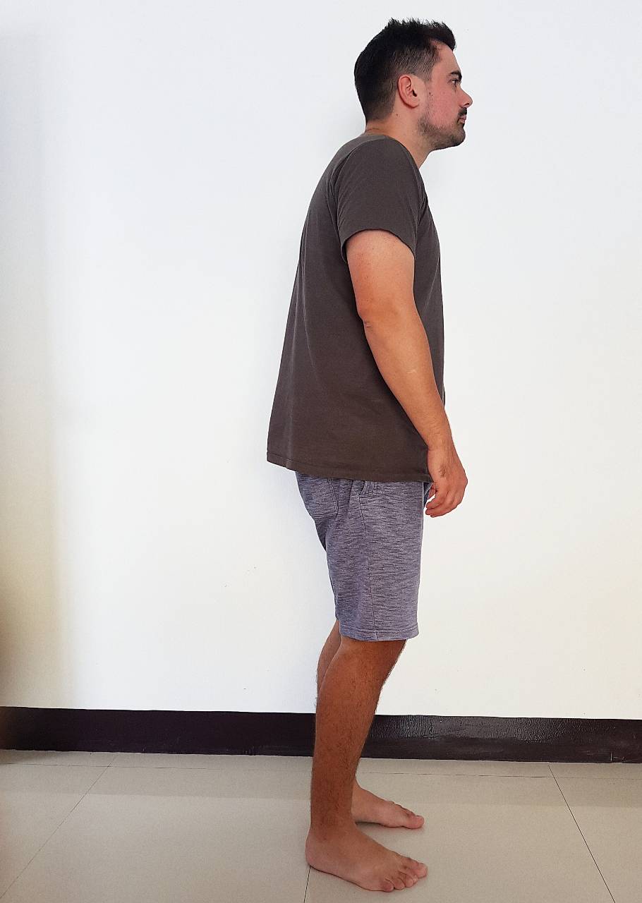 A man with bad posture with height loss wearing shorts